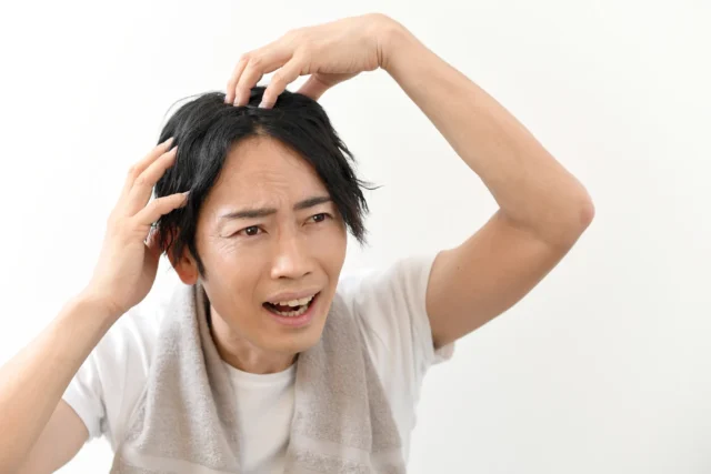 AGAは発症したら終わりと言われるのはなぜ？