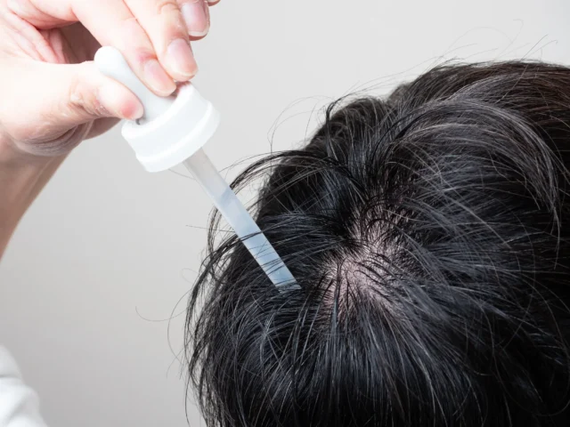 薄毛の原因によって効果的な治療法はどう変わる？