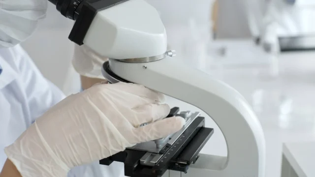 AGAの遺伝子検査で何が分かる？
