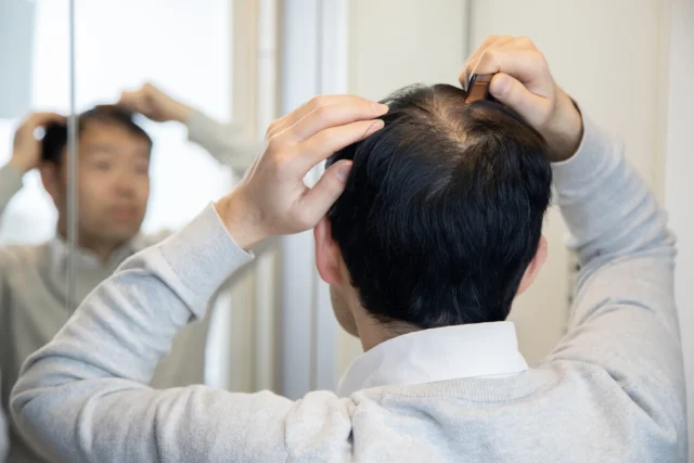 初期脱毛後の回復はどんなふうに進む?