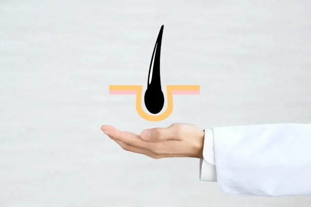 AGAの薬の効果が出るまでの期間は?