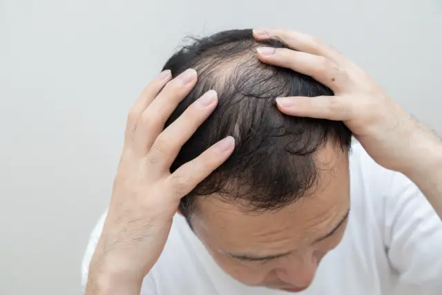 積極的に発毛させたい場合の最適解は?