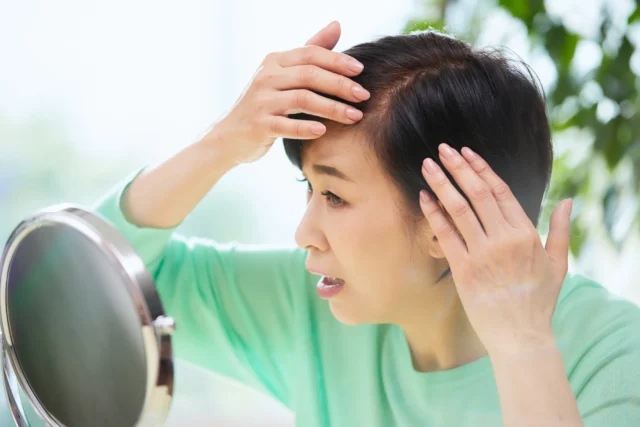 女性の薄毛治療薬を選ぶ判断基準は？