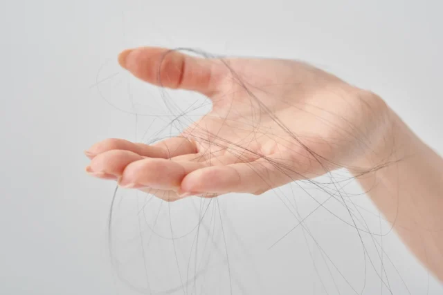 ミノキシジルの初期脱毛はなぜ起こるの?