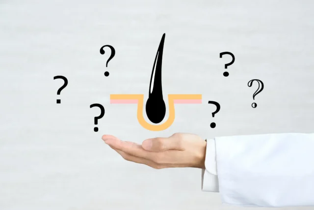AGA治療薬の副作用に関する誤解と疑問