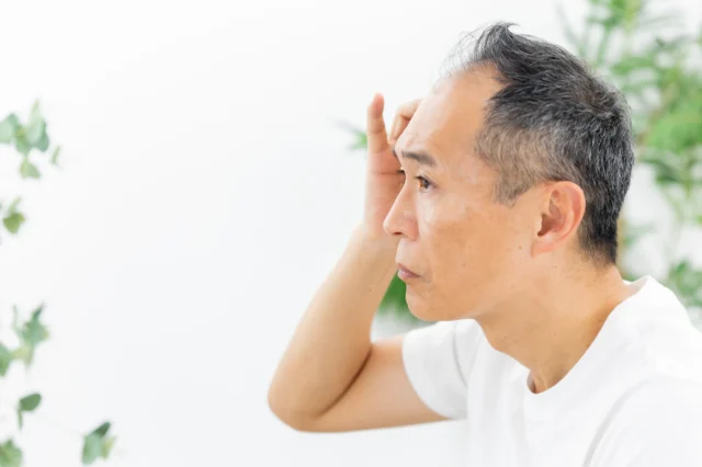 40代・50代からAGA治療を始めても効果は期待できる？