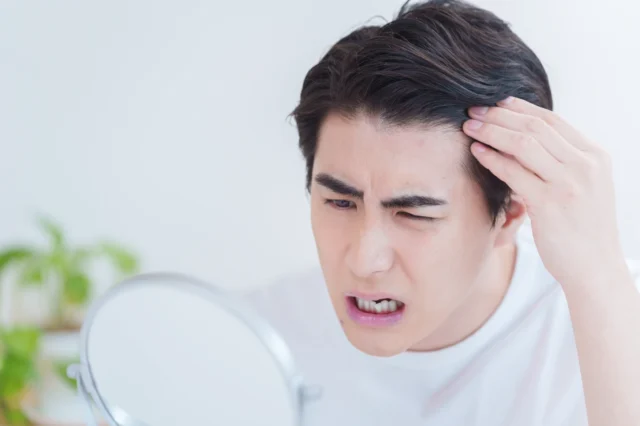 若いうちにAGAを放置するとどうなる？