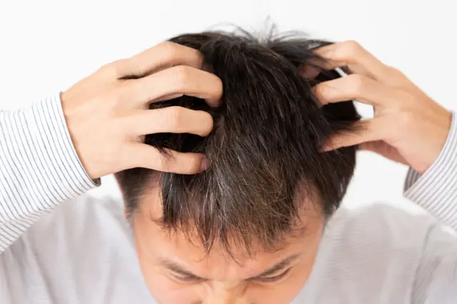 副作用が怖い…AGA治療（フィナステリド・ミノキシジル）の真実