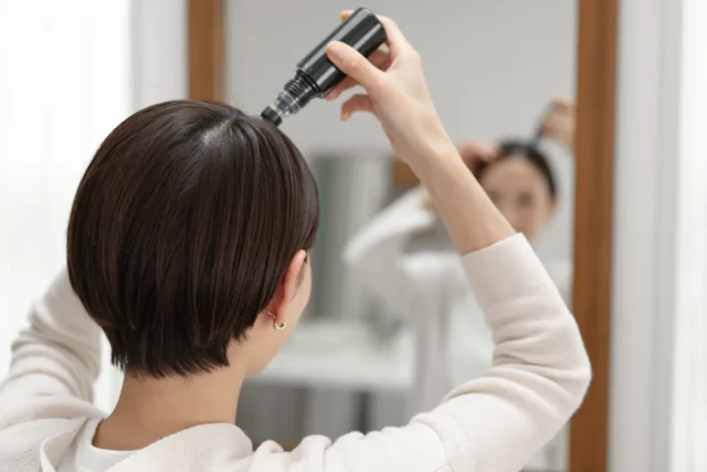 女性の薄毛治療で選ばれる主な治療方法とその特徴