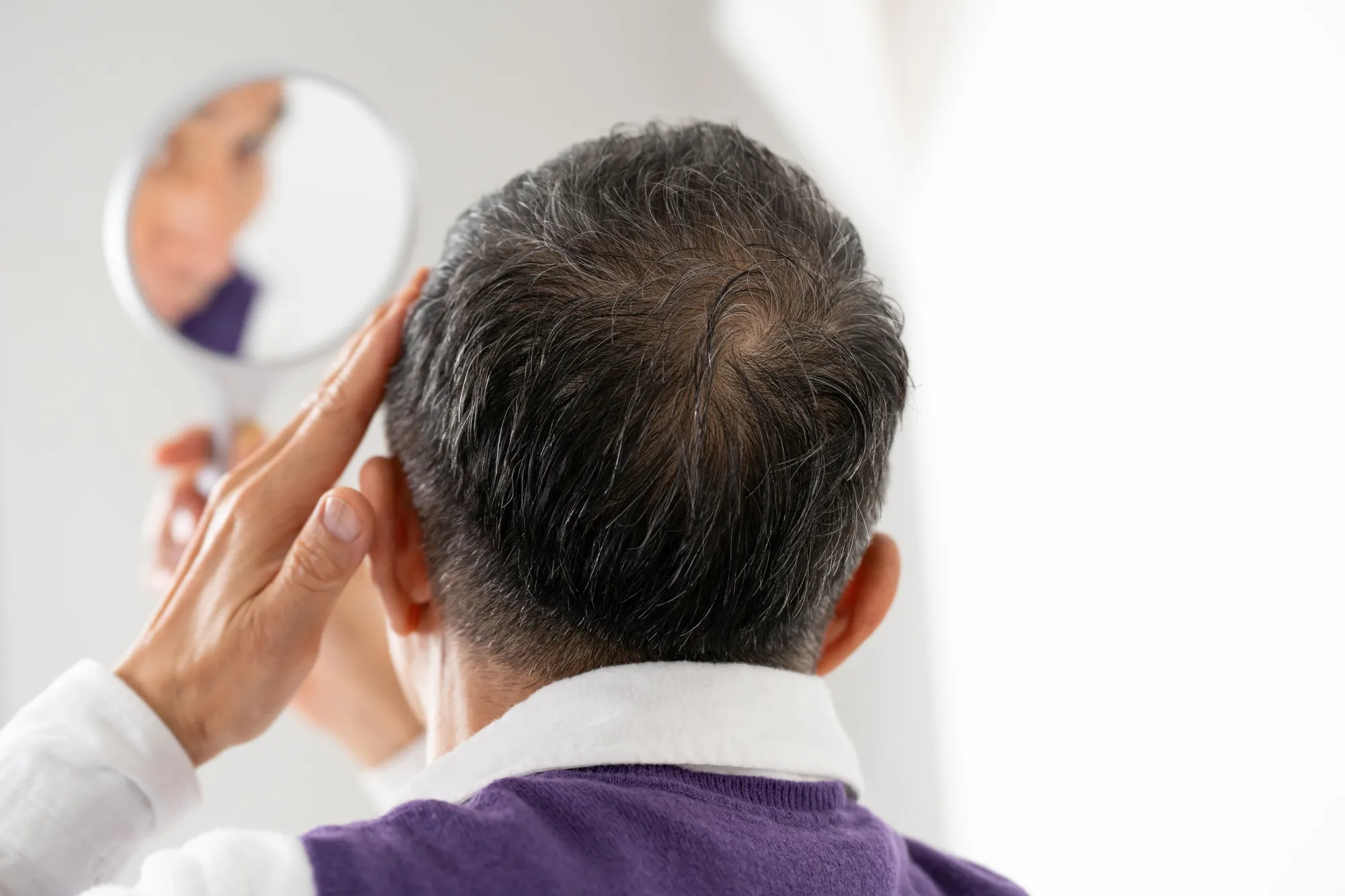 AGA治療を行ったが効果がないとあきらめてしまったあなたへ!最新薄毛治療と専門医が導く次こそ治す戦略とは?